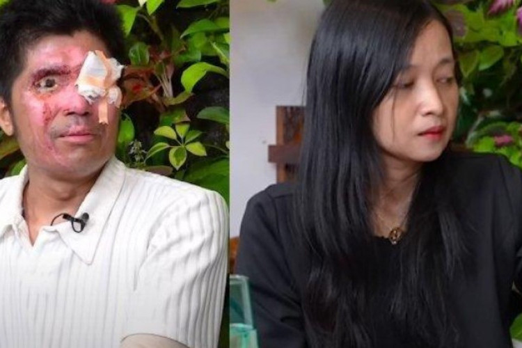 Viral! Istri Agus Salim Korban Siraman Air Keras Diduga Selewengkan Uang Donasi, Teh Novi: Ini Bukan Warisan!