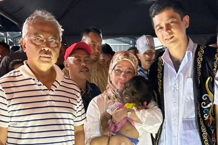 Viral Missclyen Penderita Sindrom Manusia Serigala Diadopsi Oleh Ratu Malaysia Jadi Anak Angkat 